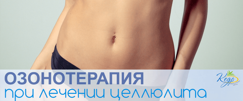 Озонотерапия при лечении целлюлита